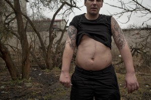 Tarmo, 33 years old and fentanyl addict for about twenty years, is seen under the influence of fentanyl in a park of Majaka, in Tallinn, Estonia on March 19, 2017. Majaka is considered to be among the neighborhoods with the higest number of fentanyl addicts in the city.