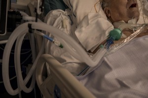 A patient lies in bed inside the coronavirus intensive care unit of the “Poliambulanza Foundation” hospital in Brescia, Italy on April 9, 2020. “Poliambulanza Foundation” is a non-profit multispecialist private hospital, affiliated with the National Health Service.