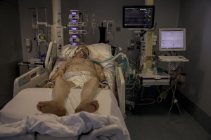 A patient lies in bed inside the coronavirus intensive care unit of the “Papa Giovanni XXIII” hospital in Bergamo, Northern Italy on April 17, 2020.