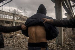 A migrant from Afghanistan shows the scars that according to his testimony, would have been caused by the violence of the Croatian police, while several months ago he tried to cross the border in Bihac, Bosnia and Herzegovina on January 22, 2021. Lots of migrants avoid staying inside the Bosnian official refugee camps because of the hard conditions in which they are forced to live and also because the people hosted in the official camps  cannot go out freely.